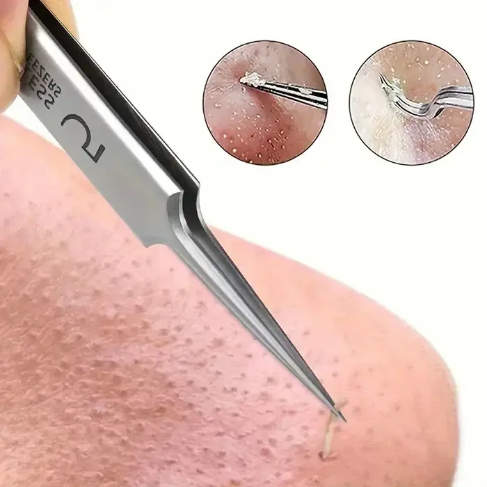 Pince extra fine n ° 5 pour les soins de la peau, accessoire pour éliminer l'acné, les points noirs, la beauté du visage, 1 pièce
